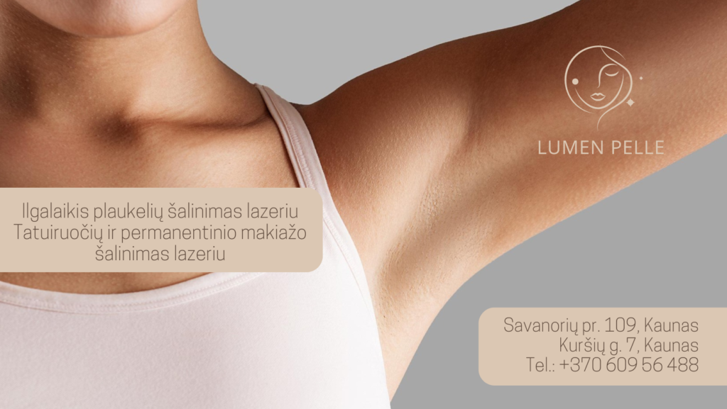 Ilgalaikis plaukelių šalinimas lazeriu (1)